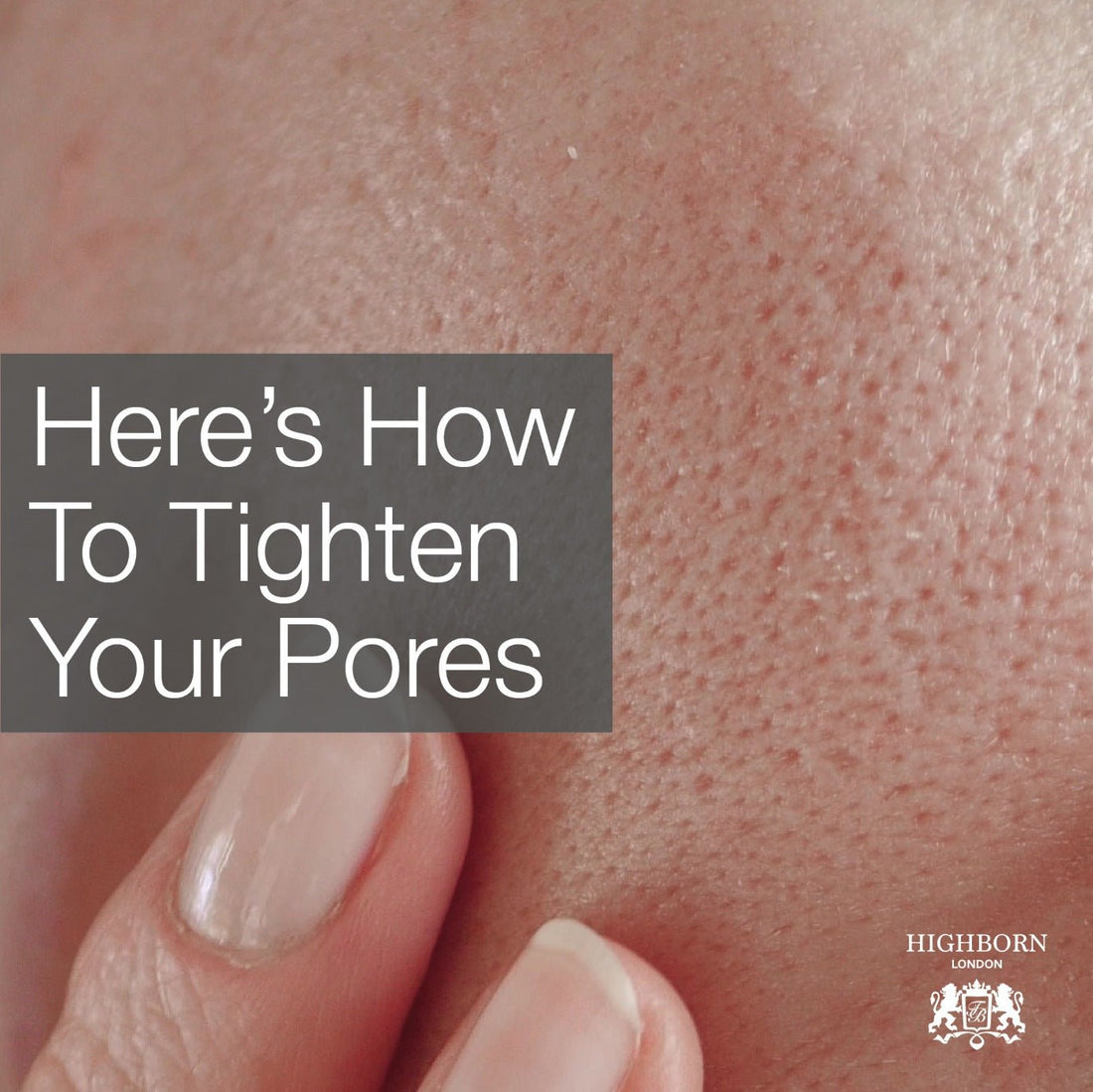 10 Important Lessons For Dealing With Enlarged Pores - HighBorn London