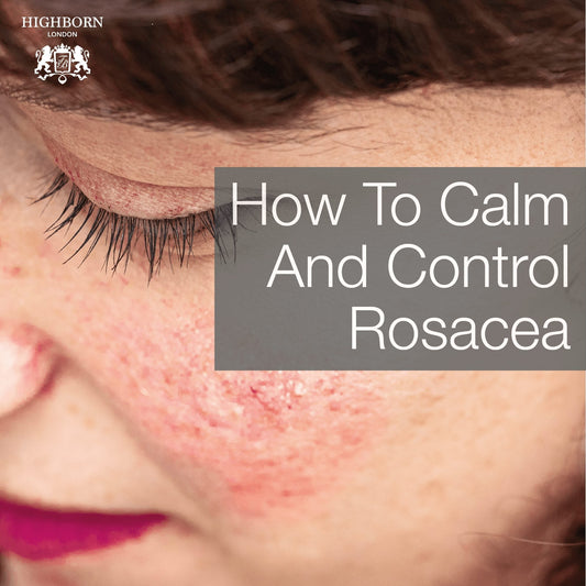 Rosacea: What It Is & How Best To Treat It - HighBorn London