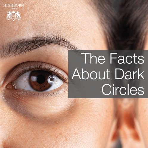 The Truth About Dark, Under-Eye Circles - HighBorn London